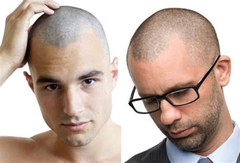 Cabelo Raspado Na 1 - Cortes De Cabelo Raspado Masculino - Cortes Cabelo