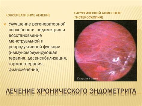 Воспалительные заболевания половых органов неспецифической этиологии ...
