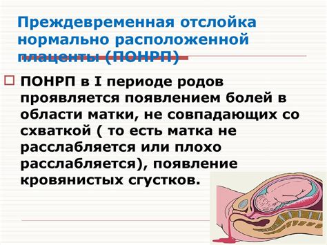 Акушерские кровотечения при беременности - презентация онлайн