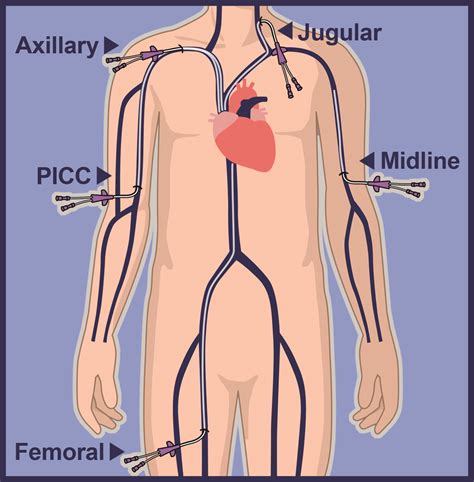 Picc Line Catheter