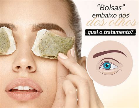 Bolsa Abaixo Dos Olhos Inchada O Que Pode Ser