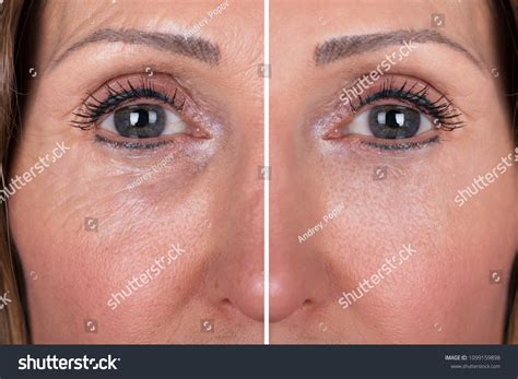 wrinkles   images stock  vectors shutterstock