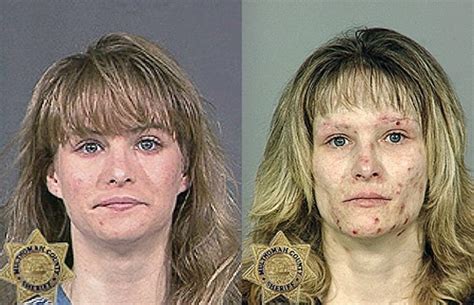 From Drugs to Mugs: Shocking before and after images show the cost of drug addiction