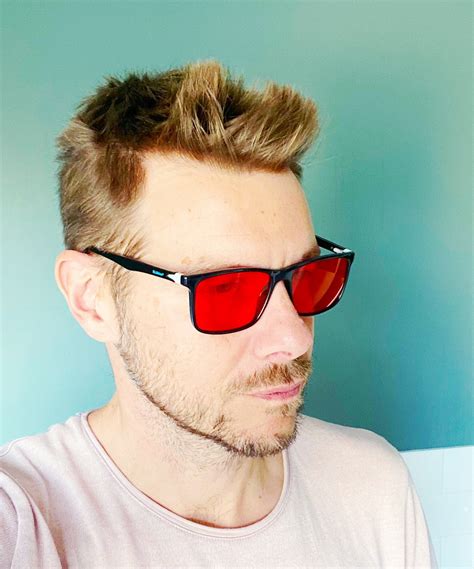 Are Peas High in Histamine? | Diet, Supplements and cutting-edge tips