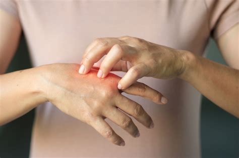 Med Journal 360 | Disease burden often age specific in epidermolysis