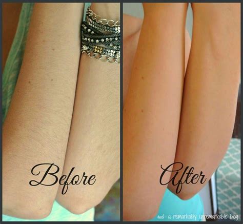 how to remove arm hair permanently