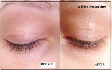 EVELINE "SOS Lash Booster" daugiafunkcinis, stiprinamasis blakstienų ...