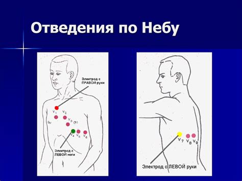 Принцип ЭКГ - online presentation