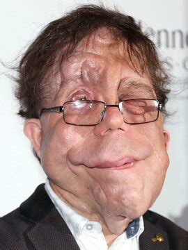 Adam Pearson - Actor