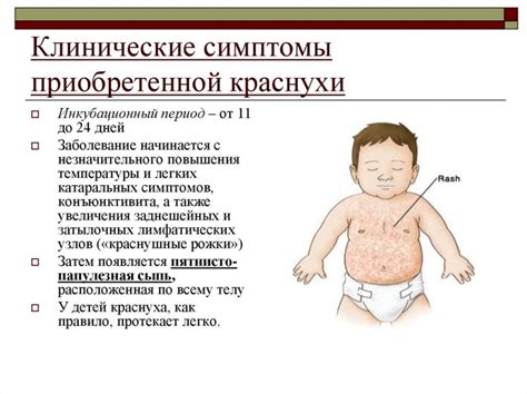 Как Проявляется Краснуха: Симптомы, Лечение + 50 ФОТО Сыпи