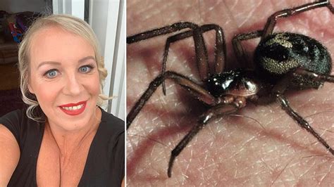 false widow spider bite leaves barry woman  hospital bbc news