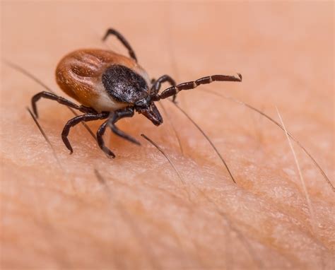 Tick-Borne Encephalitis (TBE) Vaccination - Leeds, Bradford, Wakefield ...