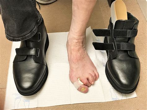 Custom Orthopedic Shoes: A Revolutionary Solution for Foot Problems ...