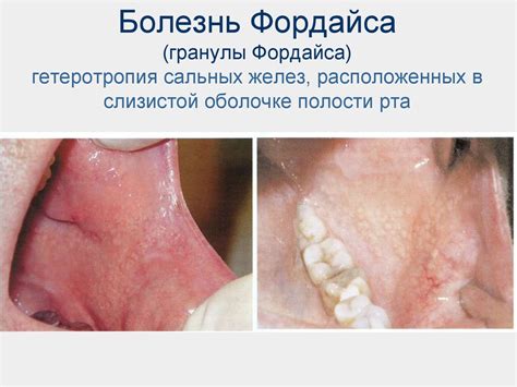 Строение и функции сальной железы - презентация онлайн