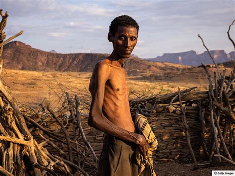 Desperation in Ethiopia as famine deepens - The Day