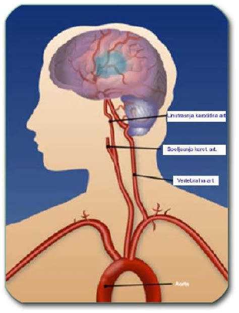 Bolesti krvnih sudova nervnog sistema - NEUROHIRURGIJA I LEČENJE BOLA