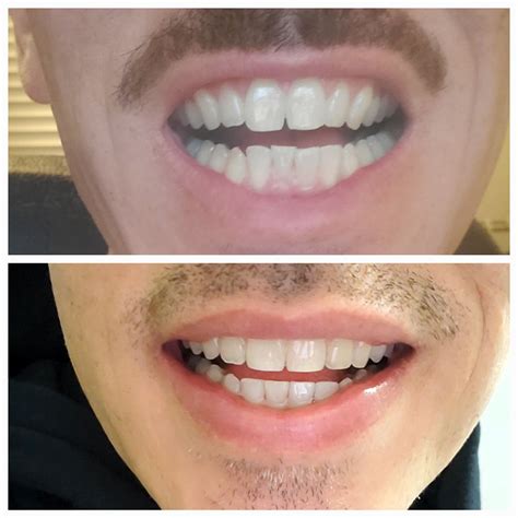 Souirensu It Works: My Before & After Will Blow You Away! Image 14