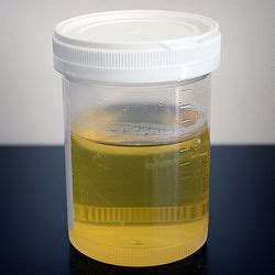 Urine therapy - Wikipedia