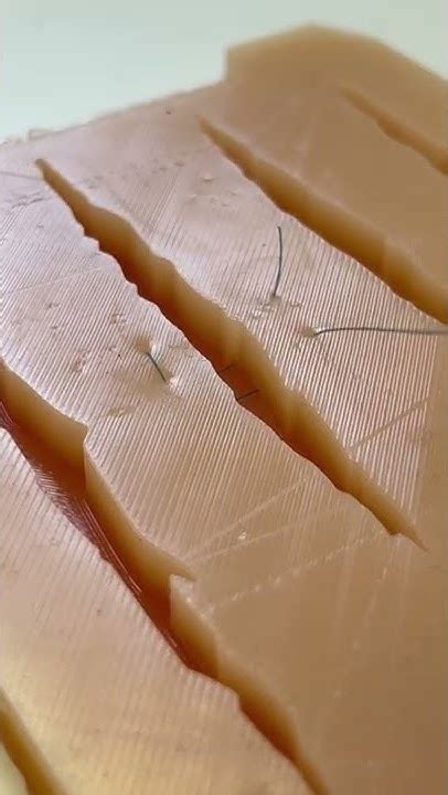 П образный шов / P Surgical suture #хирург #школахирургии # ...