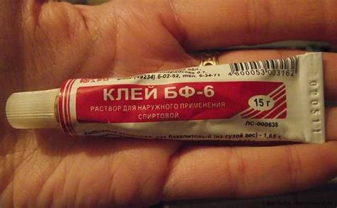 Трещины на пальцах рук возле ногтей, 4 причины и фото