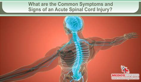 Acute Spinal Cord Injury Treatment: A Bridge to Recovery