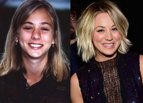 Kaley Cuoco Before and After Plastic Surgery: boob, nose