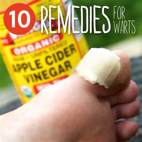 Old Fashioned Home Remedies Wart Removal - The Homestead Survival