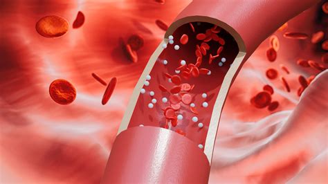 Como Melhorar A Circulacao Sanguinea - Como a cirurgia vascular pode melhorar a circulação sanguínea