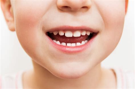 Do you know enough about milk teeth?