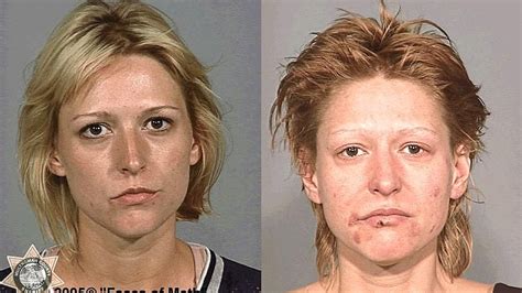 Crystal Meth: Welche verheerenden Folgen die Droge hat