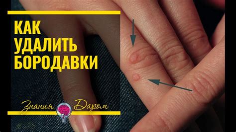 КАК ВЫВЕСТИ БОРОДАВКИ НА ПАЛЬЦАХ - YouTube