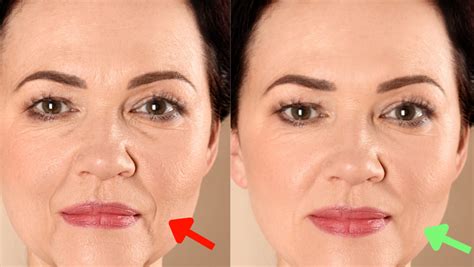 Revitalize Your Skin with the Softwave Facial Treatment - Beauty Goals ...