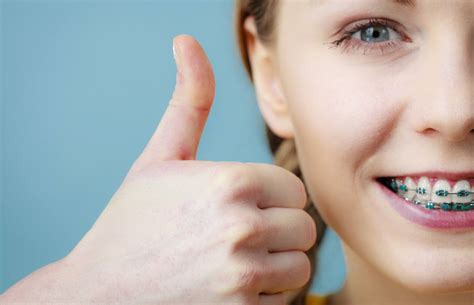 Is Teal a Good Color for Braces? - The Braces Guide