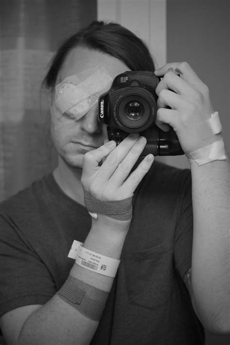 Post eye surgery, had a 15 y/o benign tumor removed. Still one of my