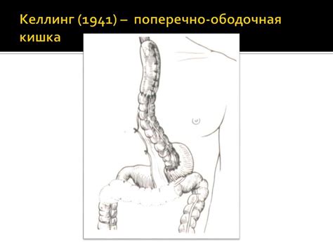 Ожоги и рубцовые сужения пищевода у детей - презентация онлайн