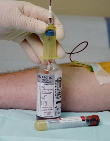 Hemocultura O Que É - HEMOCULTURA | ENFERMAGEM CONTINUADA