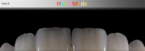 faccette accioli puccini