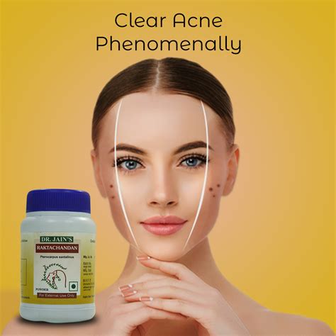 Raktachandan Powder, Removes Tan, Clears Dark Spots, Gives Natural ...