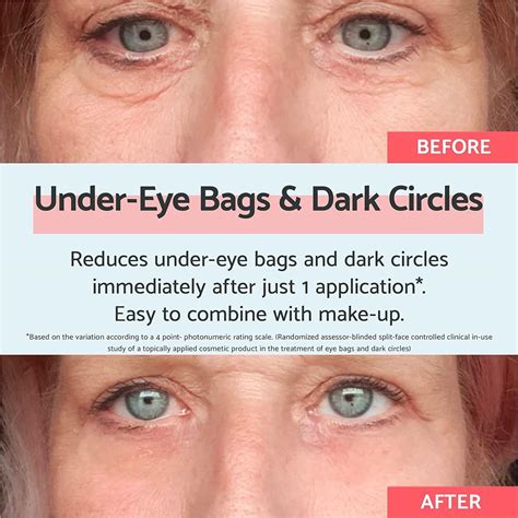how to remove bags under eyes 9