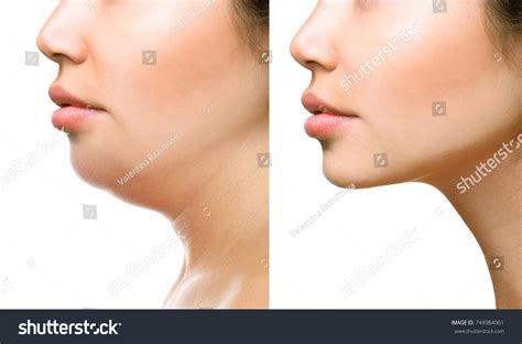 30,580 Human chin Images, Stock Photos & Vectors | Shutterstock