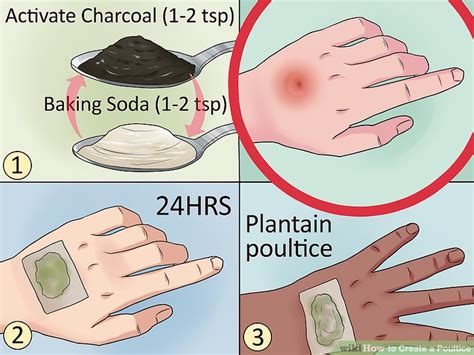 4 Ways to Create a Poultice - wikiHow