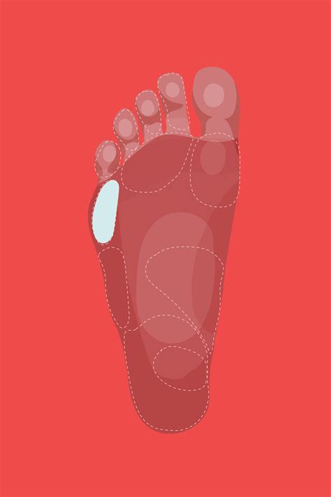 What your foot pain really means – Artofit