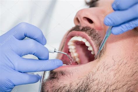 patient  plaque removal procedure royalty  stock images
