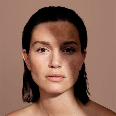 Mesoestetic – Advanced Cosmeceuticals