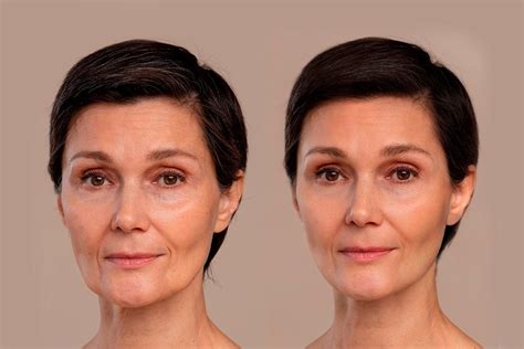 Youthful Radiance with Retinyl Palmitate: The Secret Ingredient for Ag ...