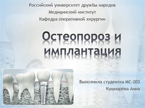 Остеопороз и имплантация - презентация онлайн