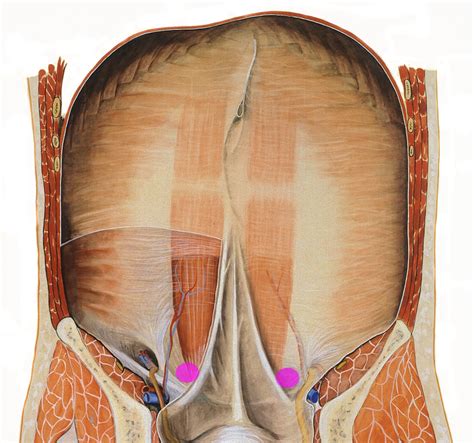 Supravesical Fossa