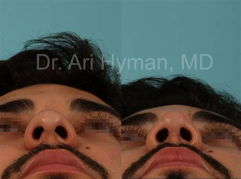 ari hyman md