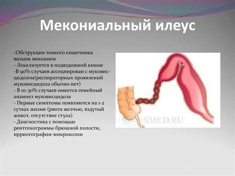 Хирургические патологии у новорожденных - презентация онлайн