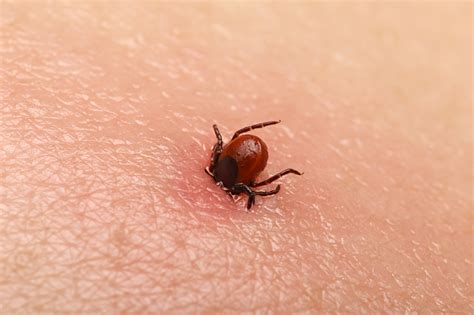 protect   tick bites nidirect